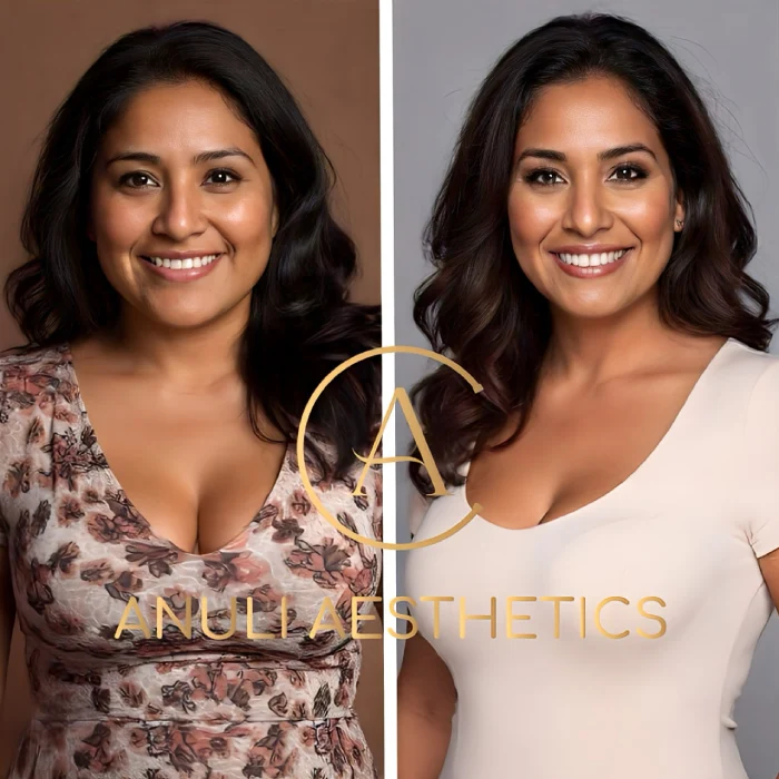 Transformative Weight Loss in Houston TX Anuli Aesthetics